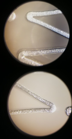 Technical progress of interventional stent coating - Cheersonic