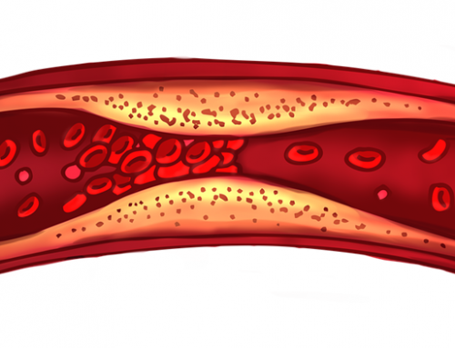 人工血管